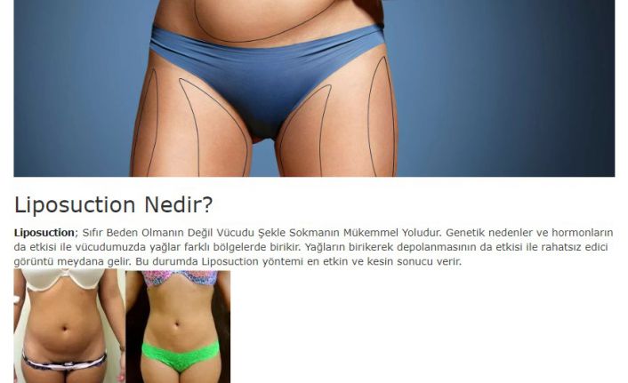 Liposuction ile Yeniden Doğuş